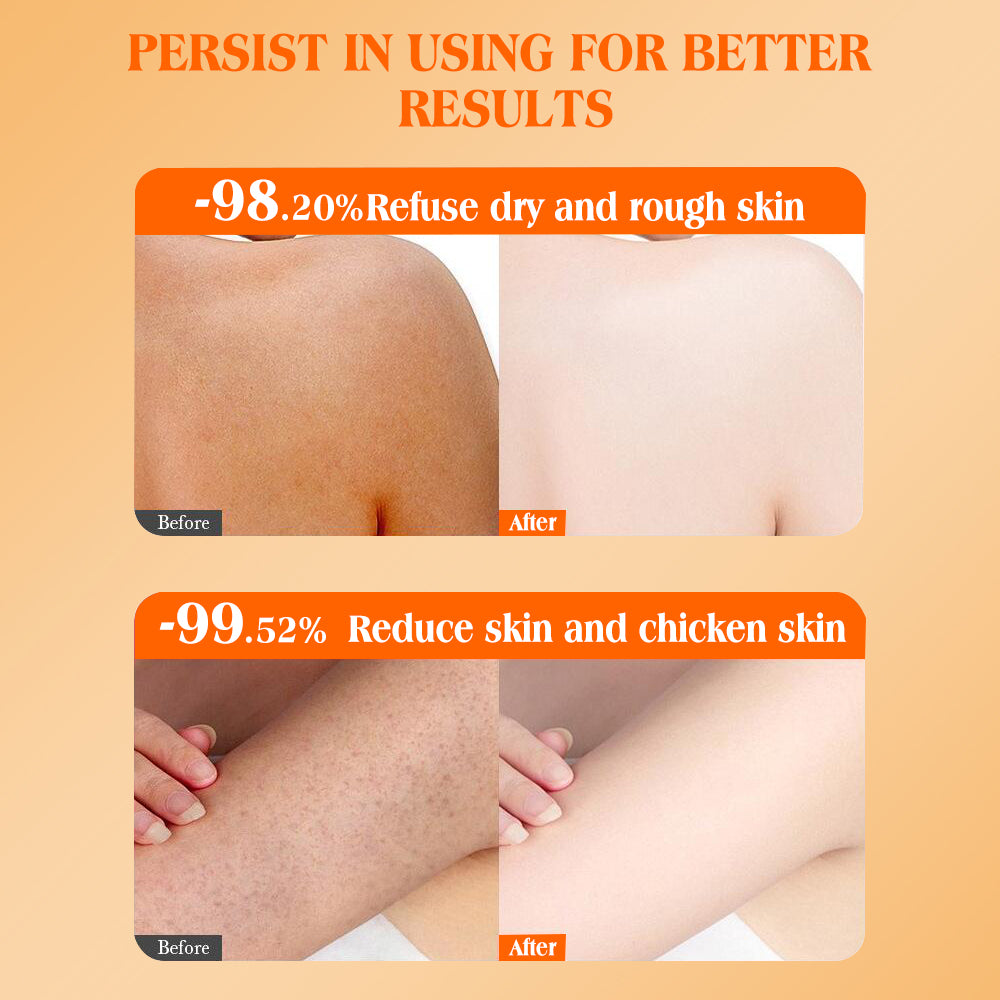 Vitamin C, moisturizing, whitening, brightening, nourishing and smoothing body lotion, 250g
