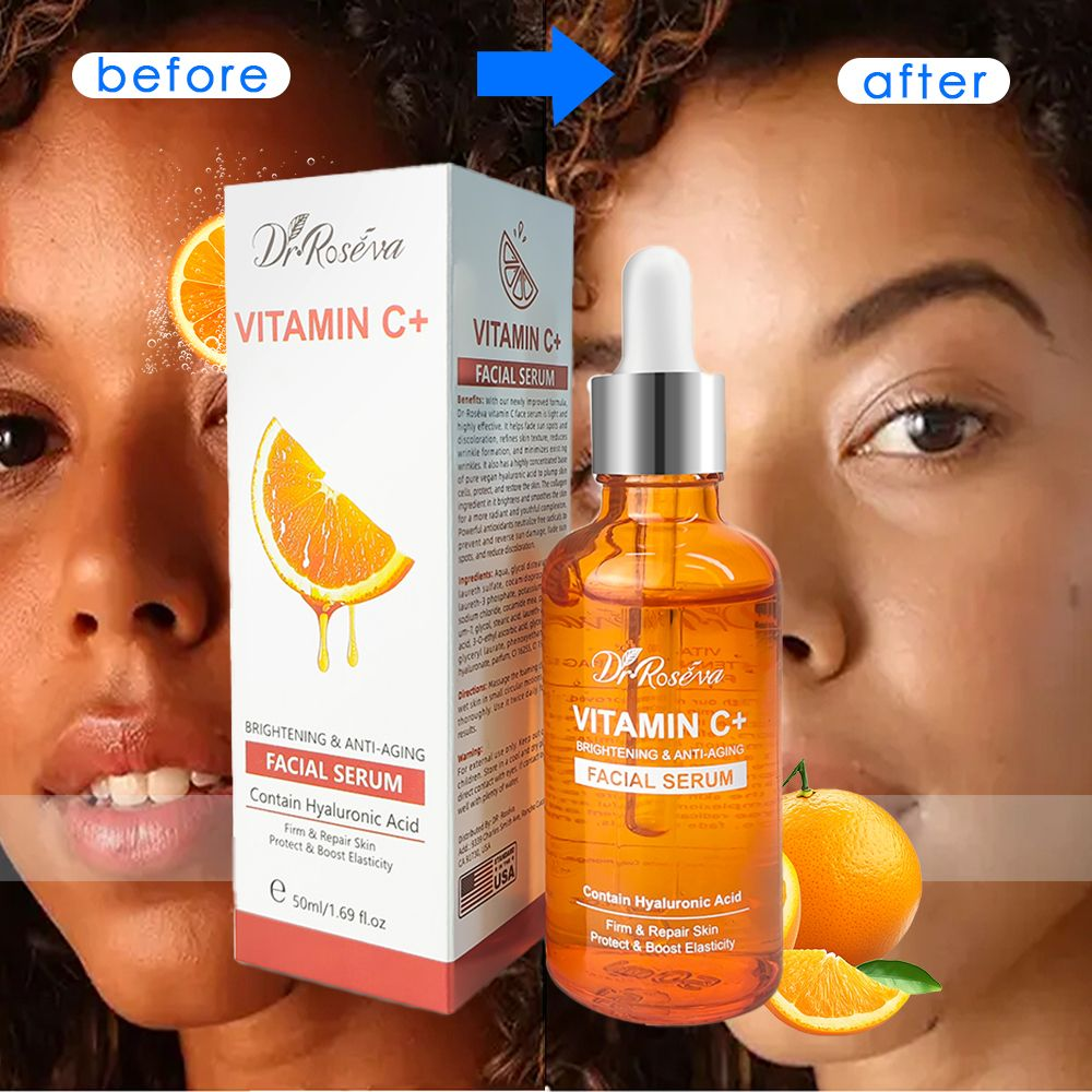 Vitamin C Face Serum - Hydrating and Nourishing Skin (50ml)