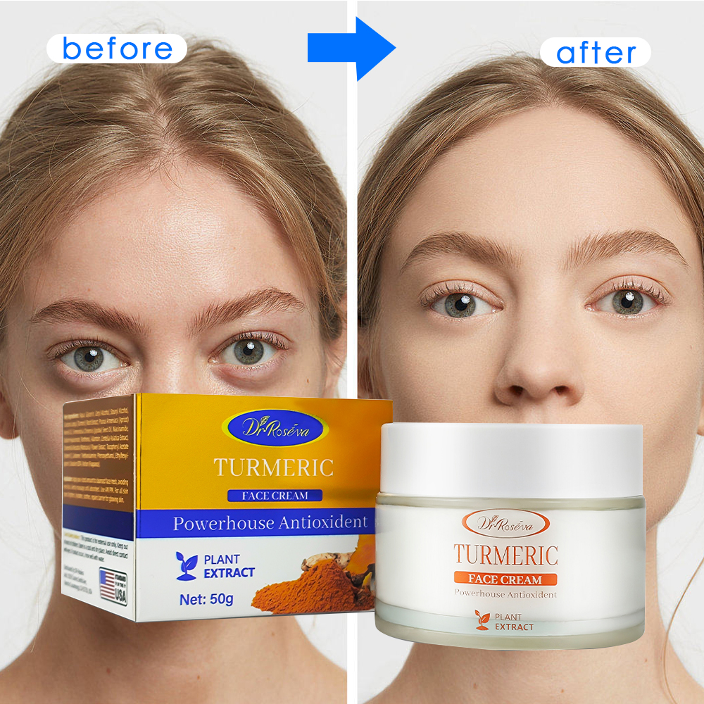 Turmeric, Dark Spot Removal Antioxidant Brightening Cream, 50g