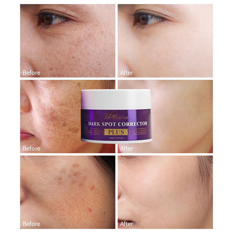 Glutathione Anti-Wrinkle Dark Spot Repair Cream, 100g