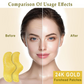 24K Gold Water Collagen Forehead and Face Anti-Wrinkle Patches, 3 Pieces