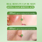 Natural plant aloe vera foam cleanser acne-fighting, brightening and moisturizing cleanser 100g