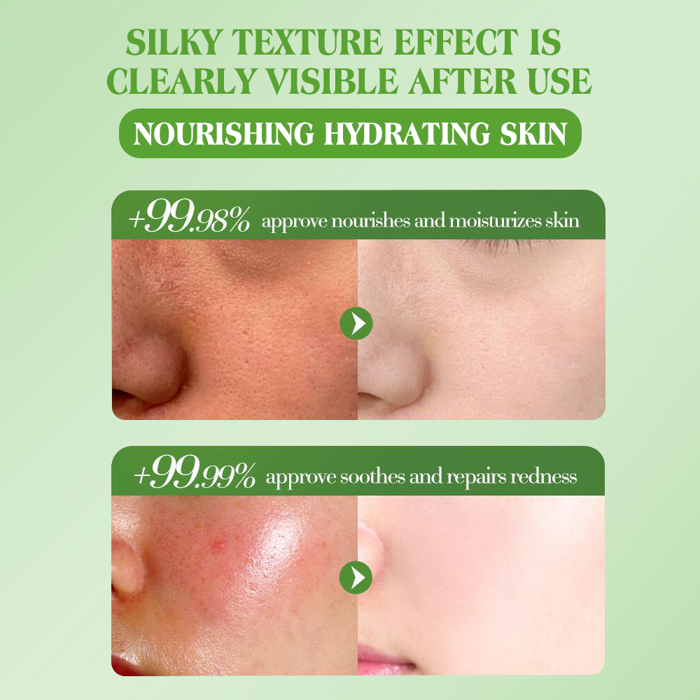 Natural Skincare Aloe Vera Nourishing Facial Essence Lotion Whitening and Hydrating 120ml