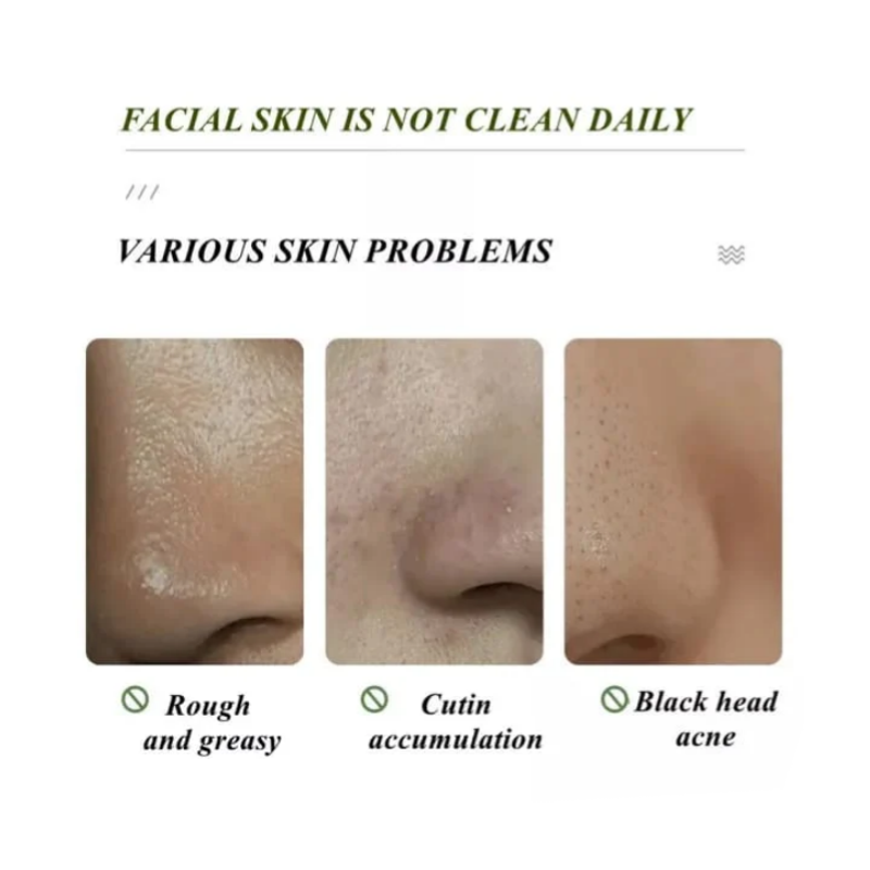 Green Tea Collagen Nose Strips, 1 box - 10 pieces