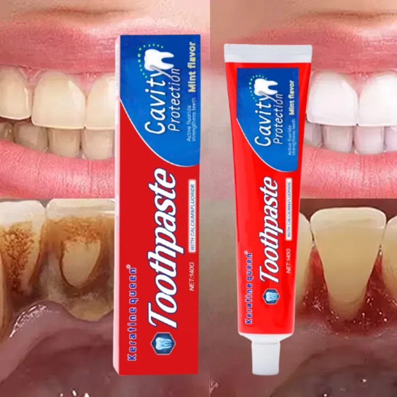 Keratin Queen Anti-Cavity Toothpaste with Calcium and Fluoride. 140g