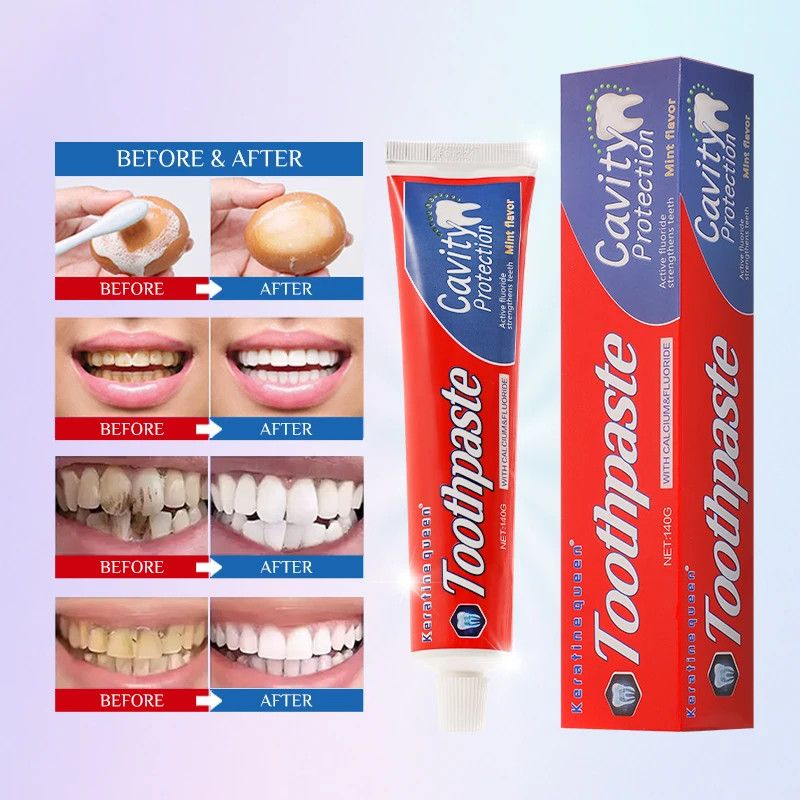 Keratin Queen Anti-Cavity Toothpaste with Calcium and Fluoride. 140g