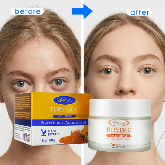 Turmeric, Dark Spot Removal Antioxidant Brightening Cream, 50g